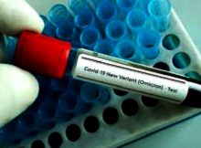 First case of Omicron Covid-19 Variant in the US confirmed by the CDC