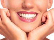 Benefits of Tooth Alignment and Make Your Smile Good