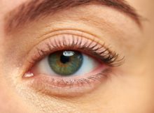 What Essential Factors do You Need to Consider Before you Opt for a Blepharoplasty in Montreal?