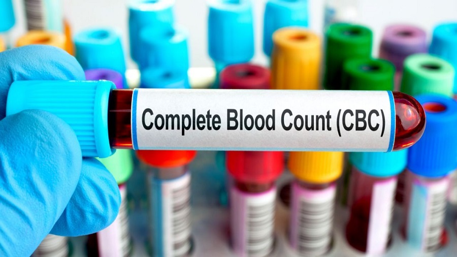 CBC Blood Test