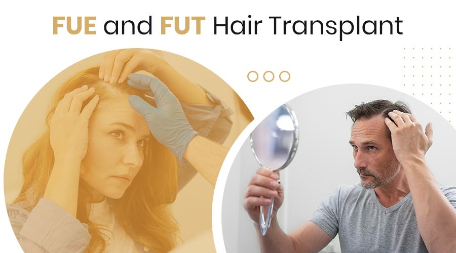 FUE and FUT Hair Transplant